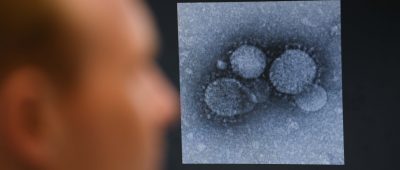 Das Coronavirus wurde jetzt bei einem Arzt im Saarland nachgewiesen. Symbolfoto: Arne Dedert/dpa-Bildfunk