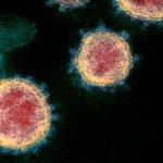 Ein Transmissionselektronenmikroskop macht das Coronavirus sichtbar. Foto: National Institute of Allergy and Infectious Diseases/CC BY 2.0