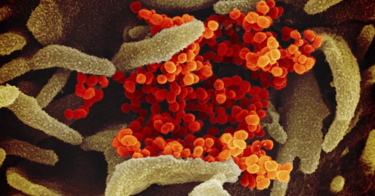 Im Saarland sind weitere Corona-Infektionen gemeldet worden. Diese Aufnahme aus dem Elektronenmikroskop zeigt das Virus (orange), das aus der Oberfläche von im Labor kultivierten Zellen (grau) austritt. Die Probe wurde von einem Patienten in den USA isoliert. Foto: NIAID-RM/dpa-Bildfunk
